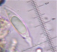 Anthostomella spore © MykoGolfer