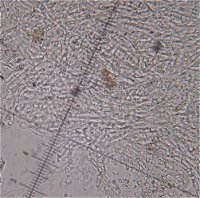 Clitocybe phyllophila hyphae © MykoGolfer