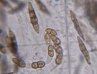 Didymosphaeria conoidea spores © MykoGolfer