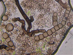 Diplococcium spicatum spores © MykoGolfer