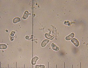 Exidiopsis effusa spores © MykoGolfer