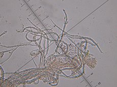Flagelloscypha minutissima © MykoGolfer