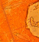 Hohenbuehelia mastrucata cystidia © MykoGolfer