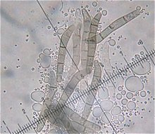 Lasiosphaeris hirsuta spores © MykoGolfer