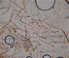 Leccinum fuscoalbum cap cells © MykoGolfer