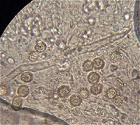 Mycenella spores © MykoGolfer
