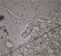 Oxyporus corticola cystidia © MykoGolfer