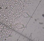 Psathyrella spadicea cystidia © MykoGolfer
