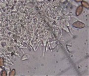 Psilocybe semilanceata cystidia © MykoGolfer