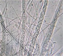 Stictis stellata spores © MykoGolfer