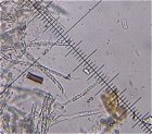 Subulicystidium longisporum © MykoGolfer