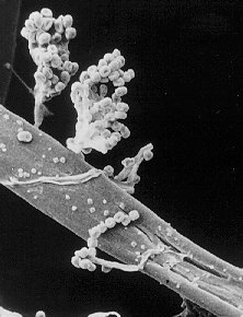 Mildew growing on cotton fibre