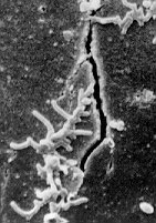 Crack in polyurethane coated fabric caused by microfungal growth