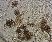 Cheiromycella microspora © MykoGolfer