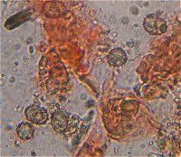 Tomentella pilosa spores © MykoGolfer
